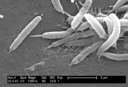 helicobacter pylori